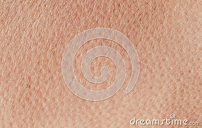 textured background from pink healthy human skin close-up anomie, covered with pores and wrinkles crawl Stock Photo