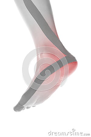 Therapeutic tape on female heel. Stock Photo