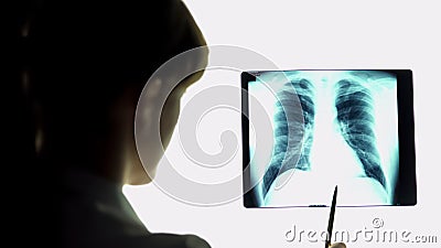 Therapist analyzing pneumonia lungs x-ray image, making conclusions, healthcare Stock Photo