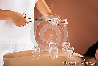 Therapist Giving Cupping Therapy To Man Stock Photo