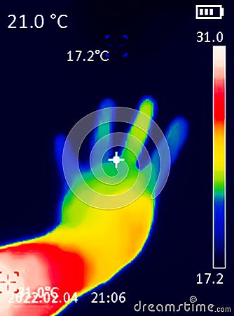 A thermographic image of a hand with a human heart, showing different temperatures in different colors, from blue indicating Stock Photo