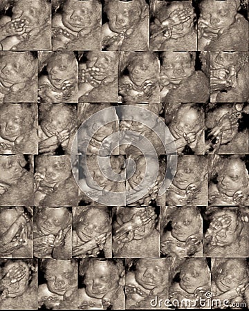 Three dimensional sonogram Stock Photo