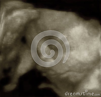 Three-Dimensional sonogram Stock Photo