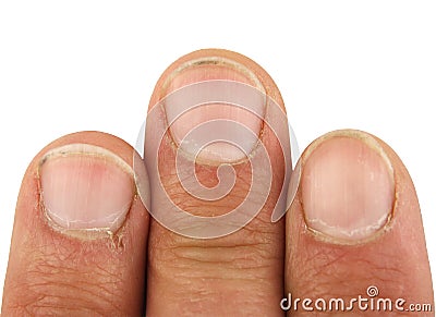 Three male fingers with dirt under the nails, closeup macro, isolated Stock Photo