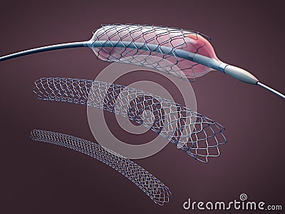 Three metal stents for implantation and supporting blood circulation into blood vessels and catheter Cartoon Illustration