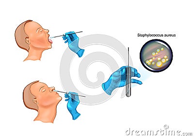 Throat and nose swab Vector Illustration