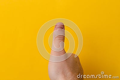 Thumbs up injured or bad finger nail on yellow background. Close up Thumb With Bad Manicure Close Up Stock Photo