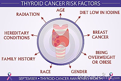 Thyroid Cancer Disease Risk Factors Infographic Vector Illustration Vector Illustration