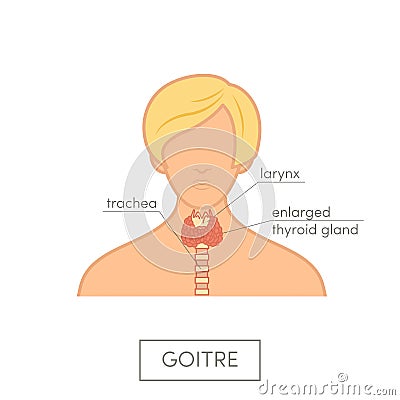 Thyroid gland anatomy of female Stock Photo