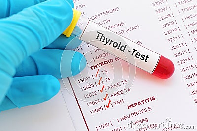 Thyroid hormone test Stock Photo