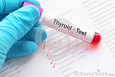 Thyroid panel test Stock Photo