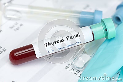 Thyroid Test Sample Stock Photo
