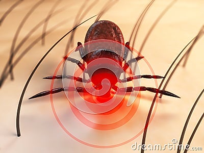 Tick bite Stock Photo