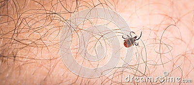 Tick - parasitic arachnid blood-sucking Stock Photo