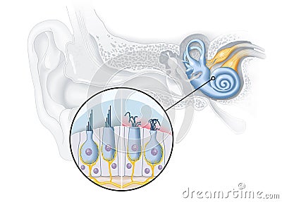 Tinnitus, healthy and damaged hair cells inside cochlea, medical illustration Stock Photo