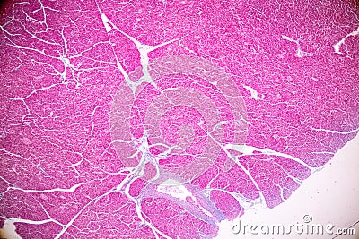 Tissue of pancreas is an organ of the digestive system and endocrine system of in humans. Stock Photo