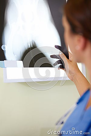 To make it right, we have to see whats wrong. A female medical professional looking at an x-ray. Stock Photo