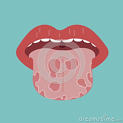 Tongue disease, vector of organ concept Vector Illustration