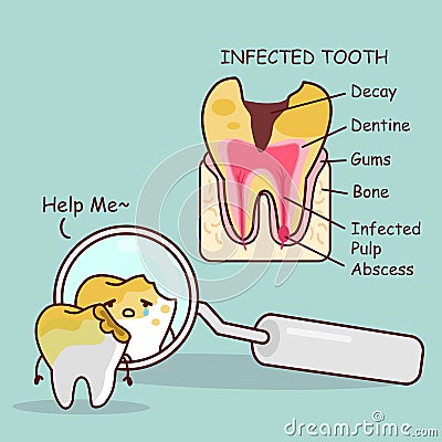 Tooth decay with health problem Vector Illustration