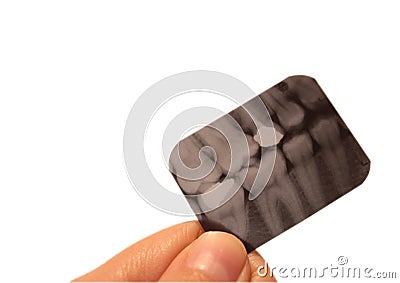 Tooth dental dentist radiograpy anatomy Stock Photo