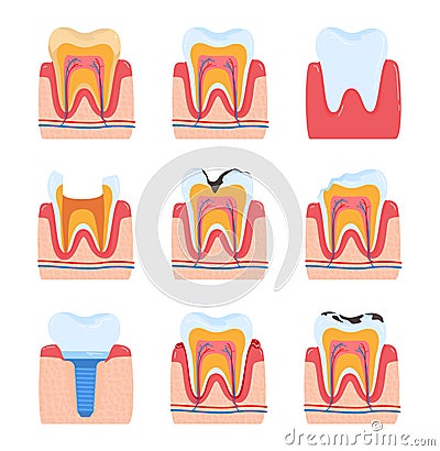 Tooth dentistry, dental teeth, oral toothache, isolated on white, medical hygiene, design, in style cartoon vector Vector Illustration