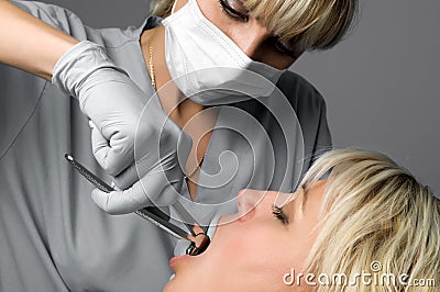 Tooth extraction Stock Photo