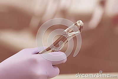 Tooth extraction Stock Photo