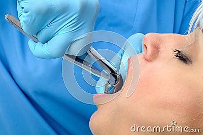 Tooth extraction Stock Photo