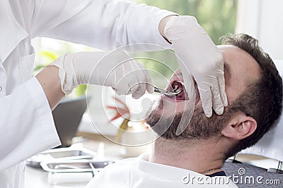 Tooth extraction in a white man. The doctor`s hands hold the forceps and catch the tooth. Stock Photo
