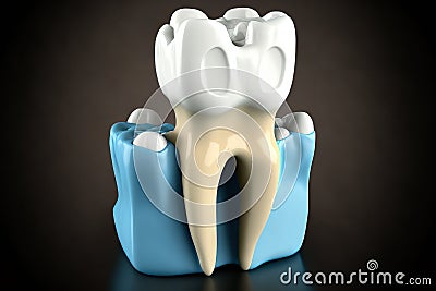 tooth that has been prepared for a dental crown. medical precision Stock Photo