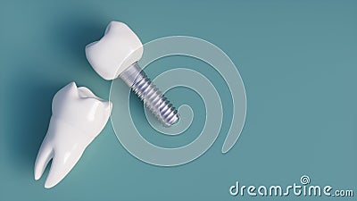 Tooth human implant - 3D Rendering Stock Photo