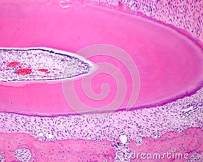 Tooth root Stock Photo