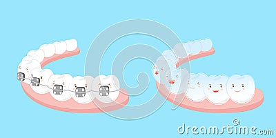 Tooth wear different brace Vector Illustration