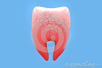 Toothache concept. Broken human Tooth on blue background. 3d illustration Cartoon Illustration