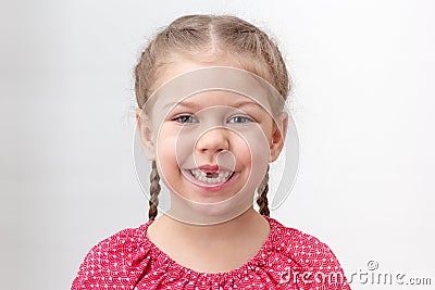 Toothless serious child without upper teeth on white background Stock Photo