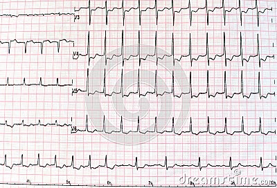 Top view of an electrocardiogram in printed paper form for health care and medical concept or background. EKG or ECG. Stock Photo