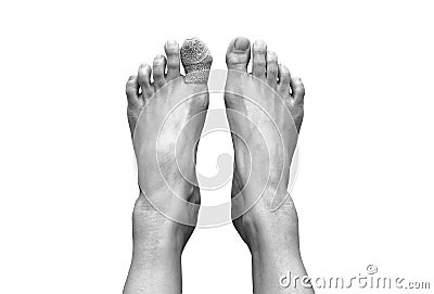 Top view picture of two bare human female feet with a wounded big toe healed with bandage for medical care. Black and white tone Stock Photo