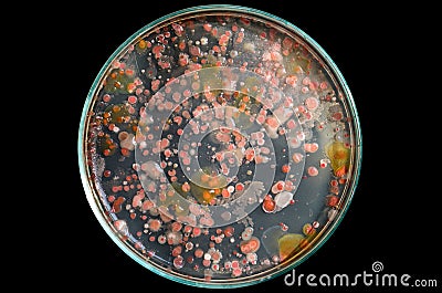 Top view soil microorganisms Nutrient agar in plate on black background Stock Photo