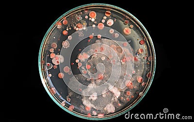 Top view soil microorganisms Nutrient agar in plate on black background Stock Photo