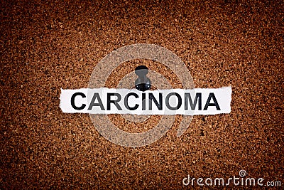 Torn piece of paper with the word Carcinoma pinned on a cork board Stock Photo