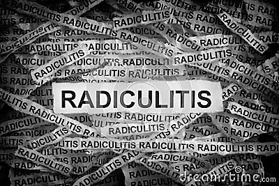 Torn pieces of paper with the word Radiculitis Stock Photo