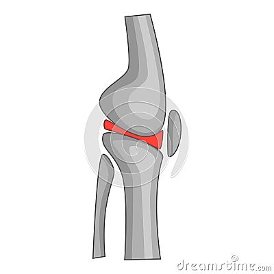 Total knee replacement surgery icon, cartoon style Vector Illustration