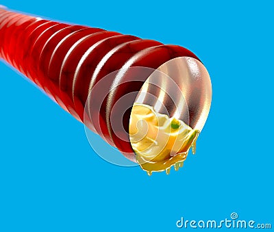 Trachea with mucus, catarrh, 3d section. Human anatomy Stock Photo