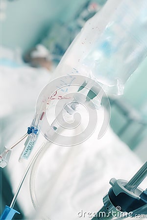 Transfusion of blood products and infusion therapy in the treatment of a seriously ill patient Stock Photo