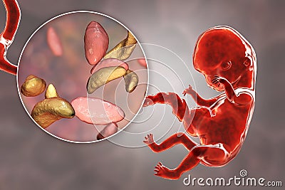 Transplacental transmission of Toxoplasma gondii parasites to human embryo Cartoon Illustration