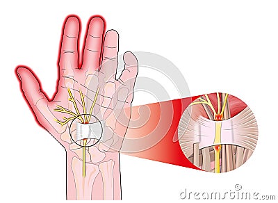 Transverse carpal ligament Stock Photo