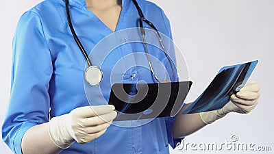 Trauma surgeon holding patient x-ray result making diagnosis, hospital treatment Stock Photo