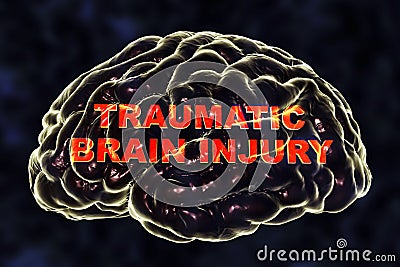 Traumatic brain injury Cartoon Illustration