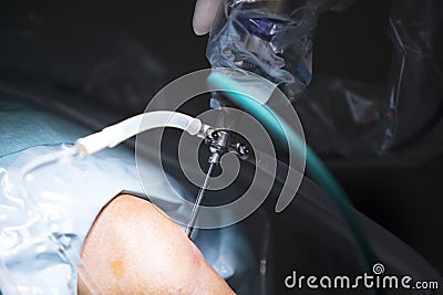 Traumatology orthopedic surgery knee arthroscopy drip Stock Photo