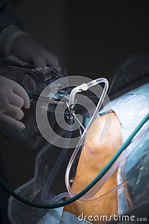 Traumatology orthopedic surgery knee arthroscopy drip Stock Photo